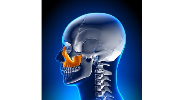 osteotomie maxillaire chirurgie du visage paris chirurgien maxillo facial paris docteur charles mathieu bandini paris 17